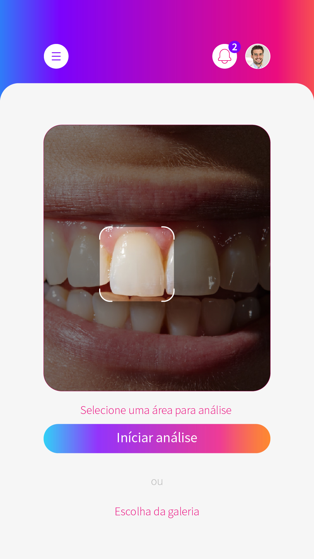 Colordente App — Análise dental